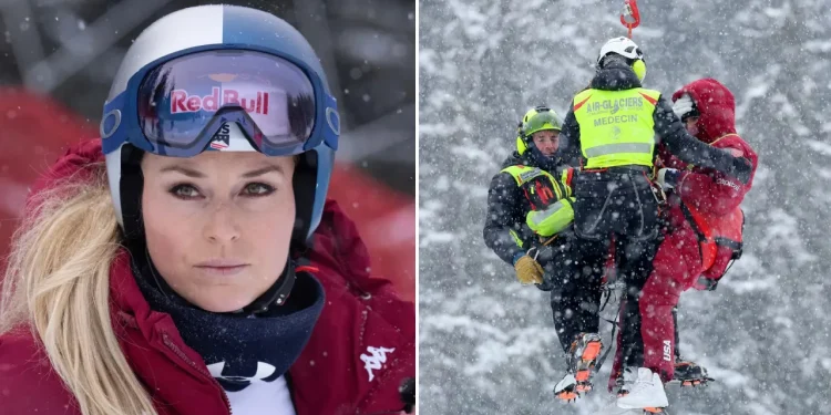 Cedera Lutut Tak Padamkan Asa Lindsey Vonn Menuju Olimpiade Milan–Cortina Foto: AFP