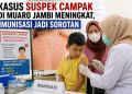 Kasus Suspek Campak di Muaro Jambi Meningkat, Imunisasi Jadi Sorotan